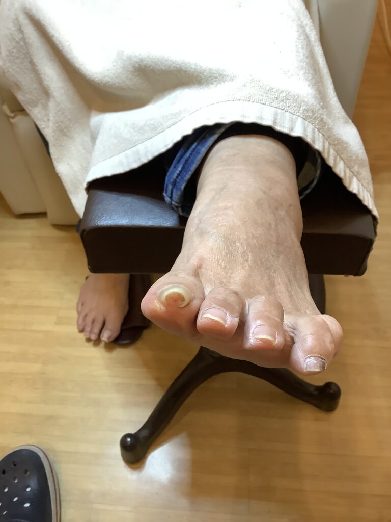 巻きが強くても ビフォー