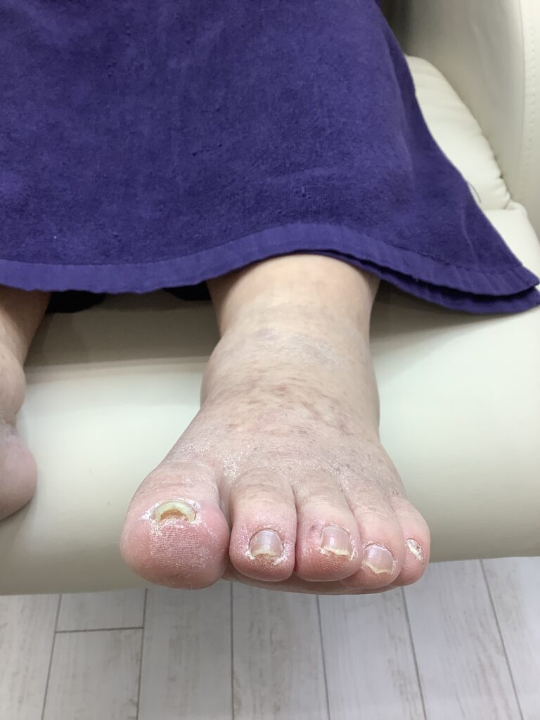 痛みがあり来店 ビフォー