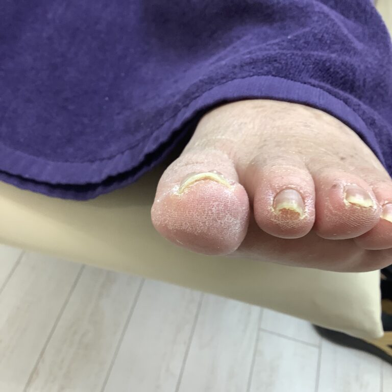 痛みがあり来店 アフター
